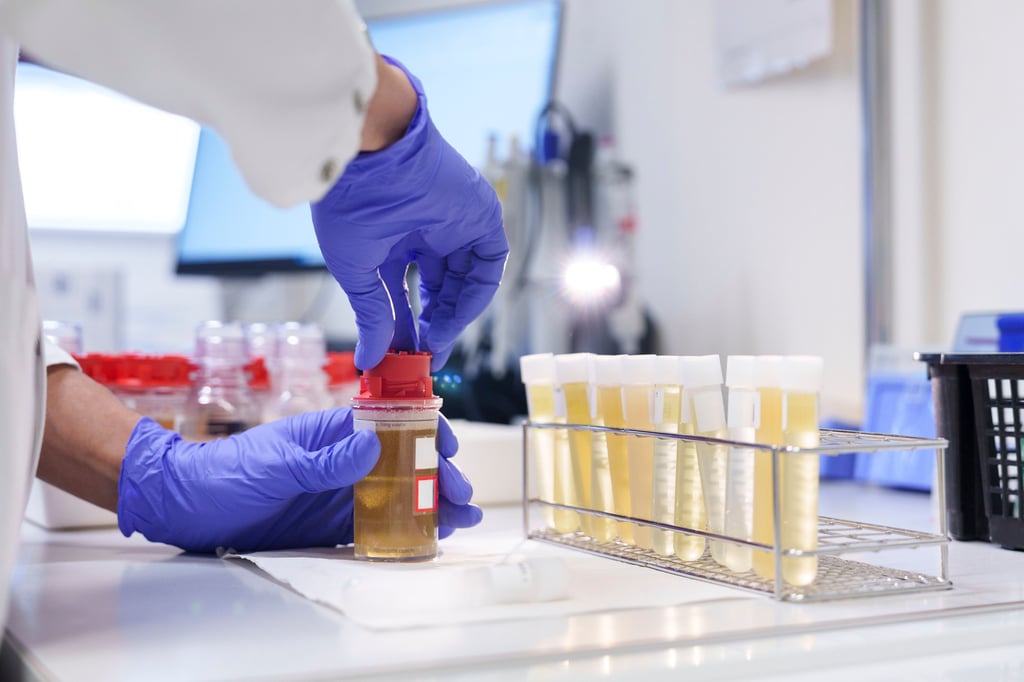 Hier entscheidet Urin über das Schicksal von Sportkarrieren