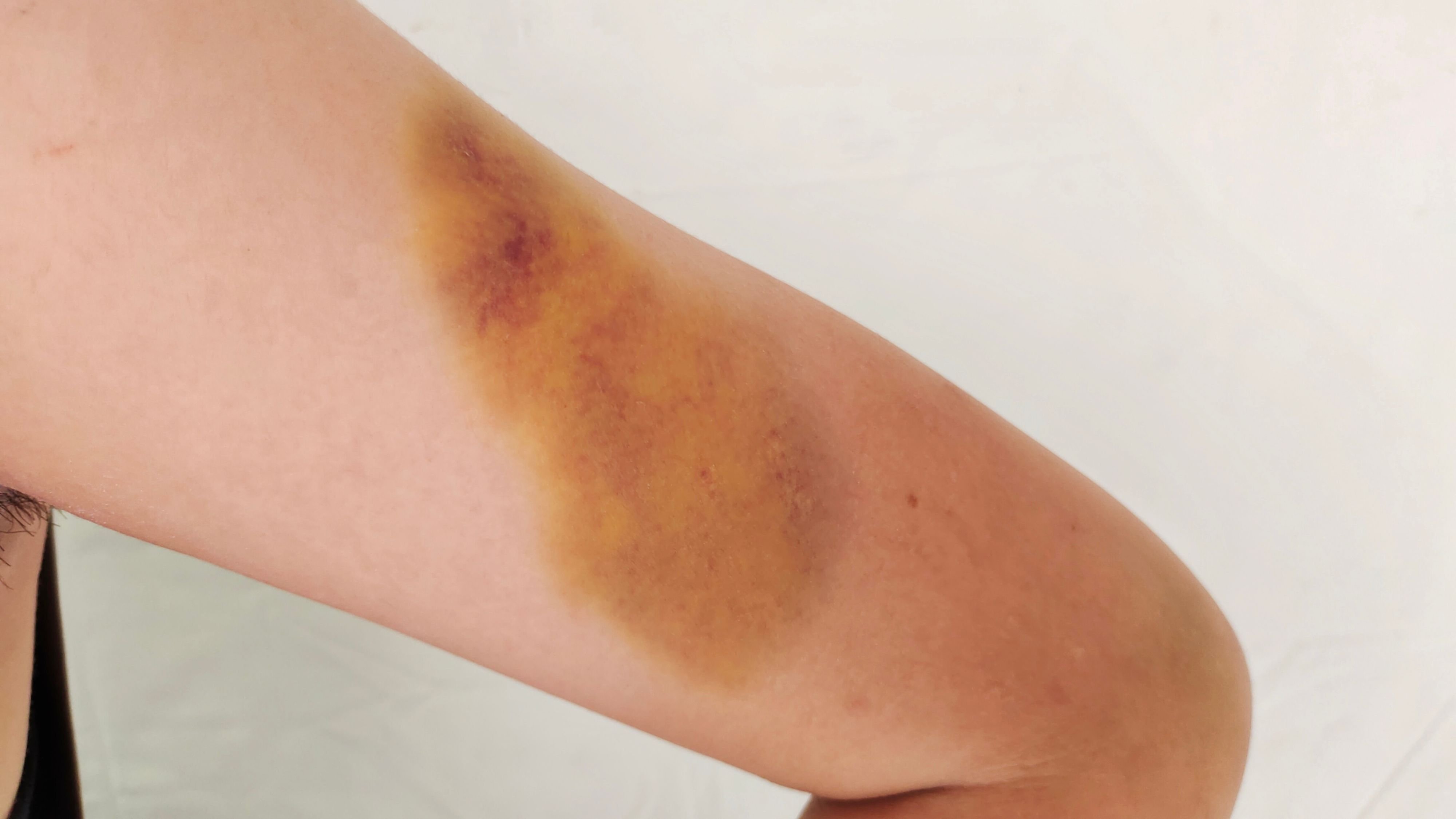 Die-Zahl-der-gemeldeten-Kindesmisshandlungen-ist-in-der-Schweiz-deutlich-gestiegen